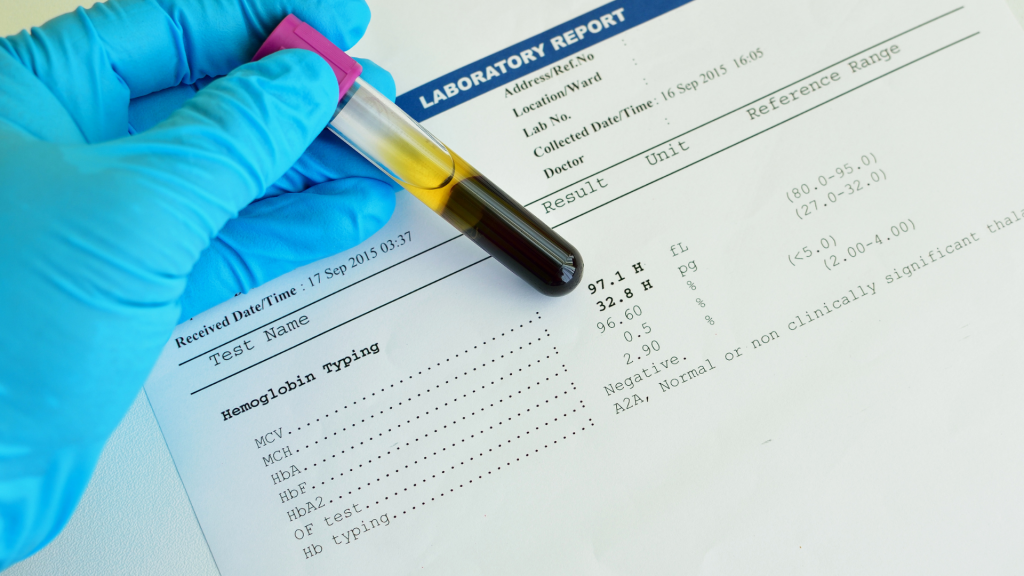 Analityk laboratoryjny sprawdza, badania krwi spełniają normy hemoglobiny.