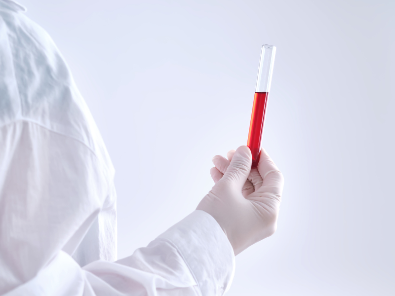 Laborant trzymający probówkę z próbką krwi do zbadania bilirubiny